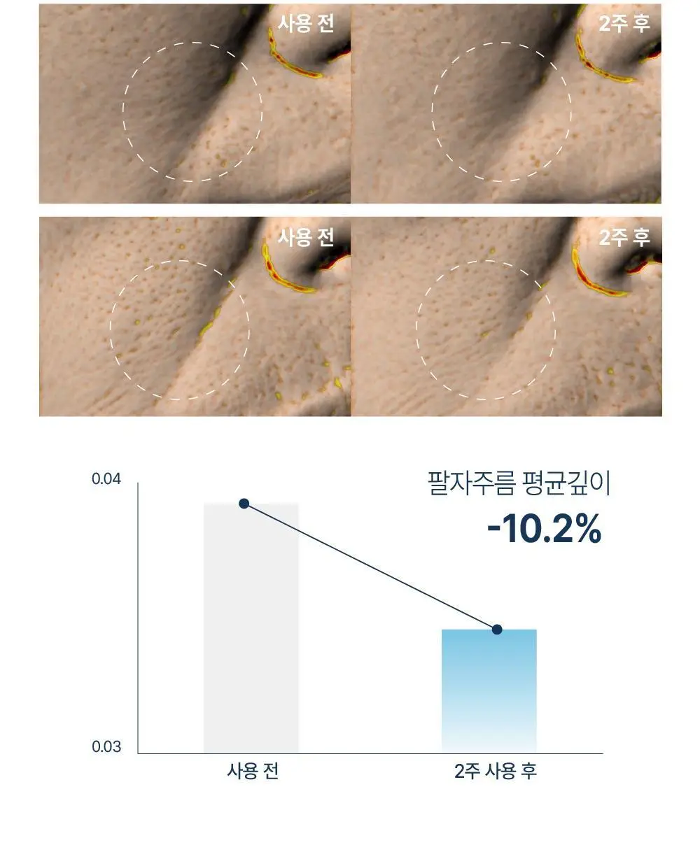 [OY단독] 라보타치 미간 케어 패치 18매 상세페이지 26